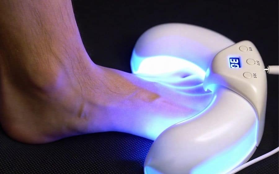 This Device Is Being Called the “Toenail Fungus Killer” by Podiatrists