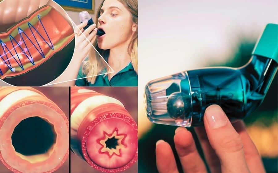 Asthma or COPD? This Genius Australian Device Helps Anyone Breath Freely