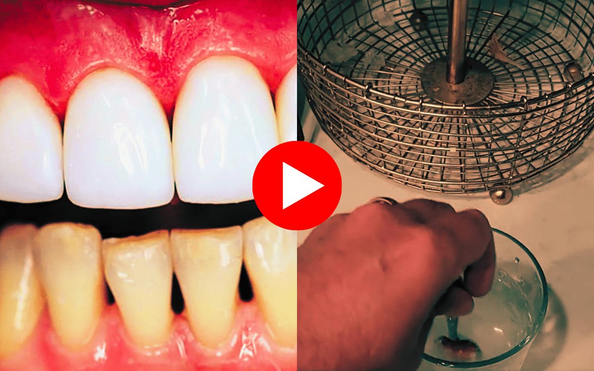 Use This Mineral To Quickly Rebuild Teeth & Gums