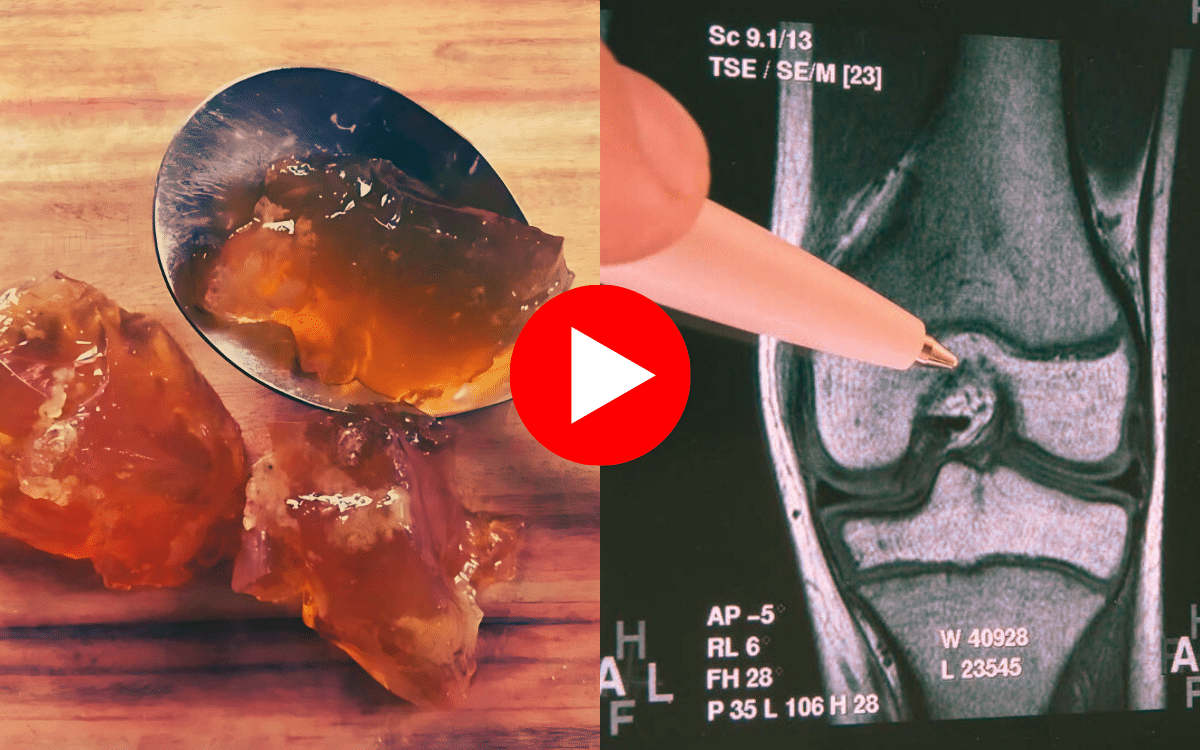 Simple “Joint Jello“ Trick Make Your Joints Immune To Pain