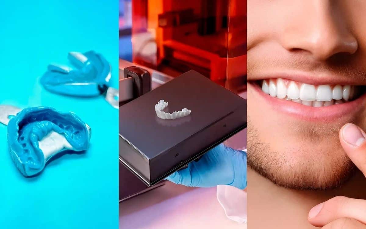 Get The Same Perfect Smile As $25,000 Veneers For Under $300