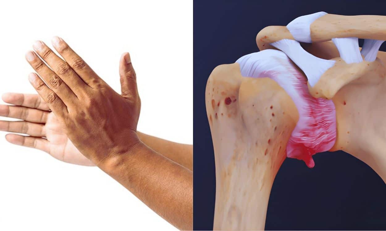 The 60-Second Hand-Clap Trick That's Helping Frozen Shoulder Faster Than Physical Therapy