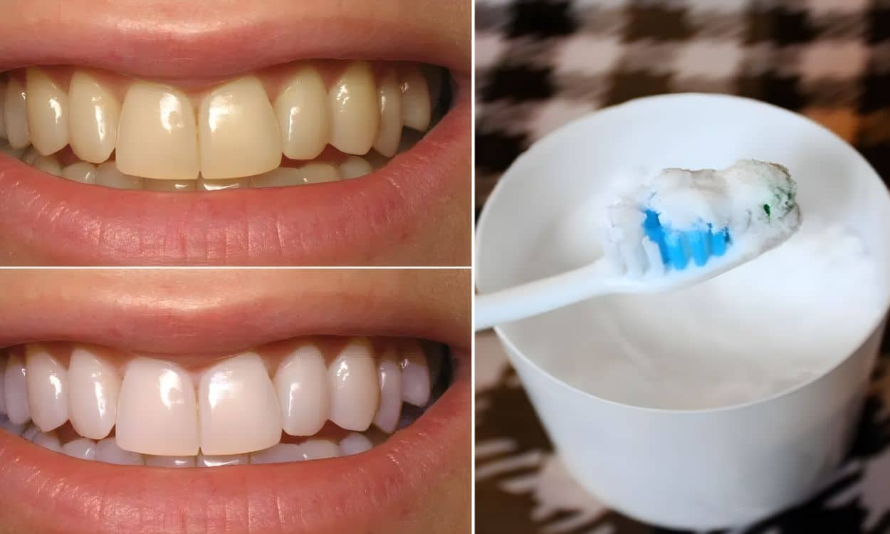 Brush Your Teeth with Baking Soda Twice a Week
